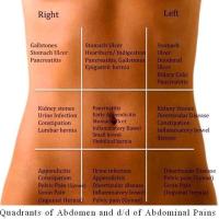 Quadrants of Abdomen and of Abdominal Pains
